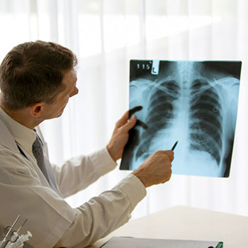 What Are VA Presumptive Conditions and How Do They Affect Veterans?